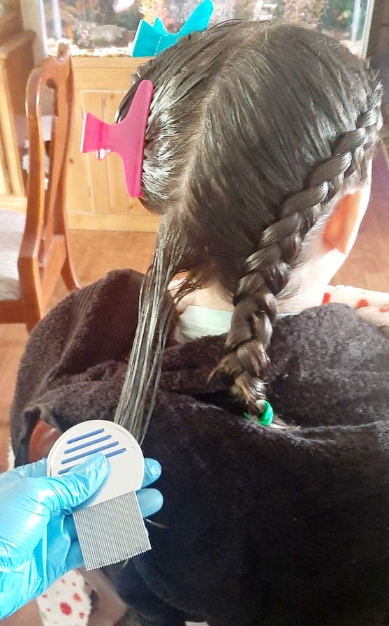 Knoxville, Tennessee Lice Treatment & Lice Removal Service LiceDoctors